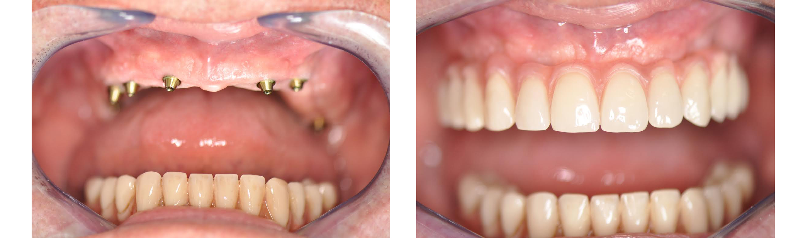 Centre Massilien De La Face Chirurgie Maxillo-faciale